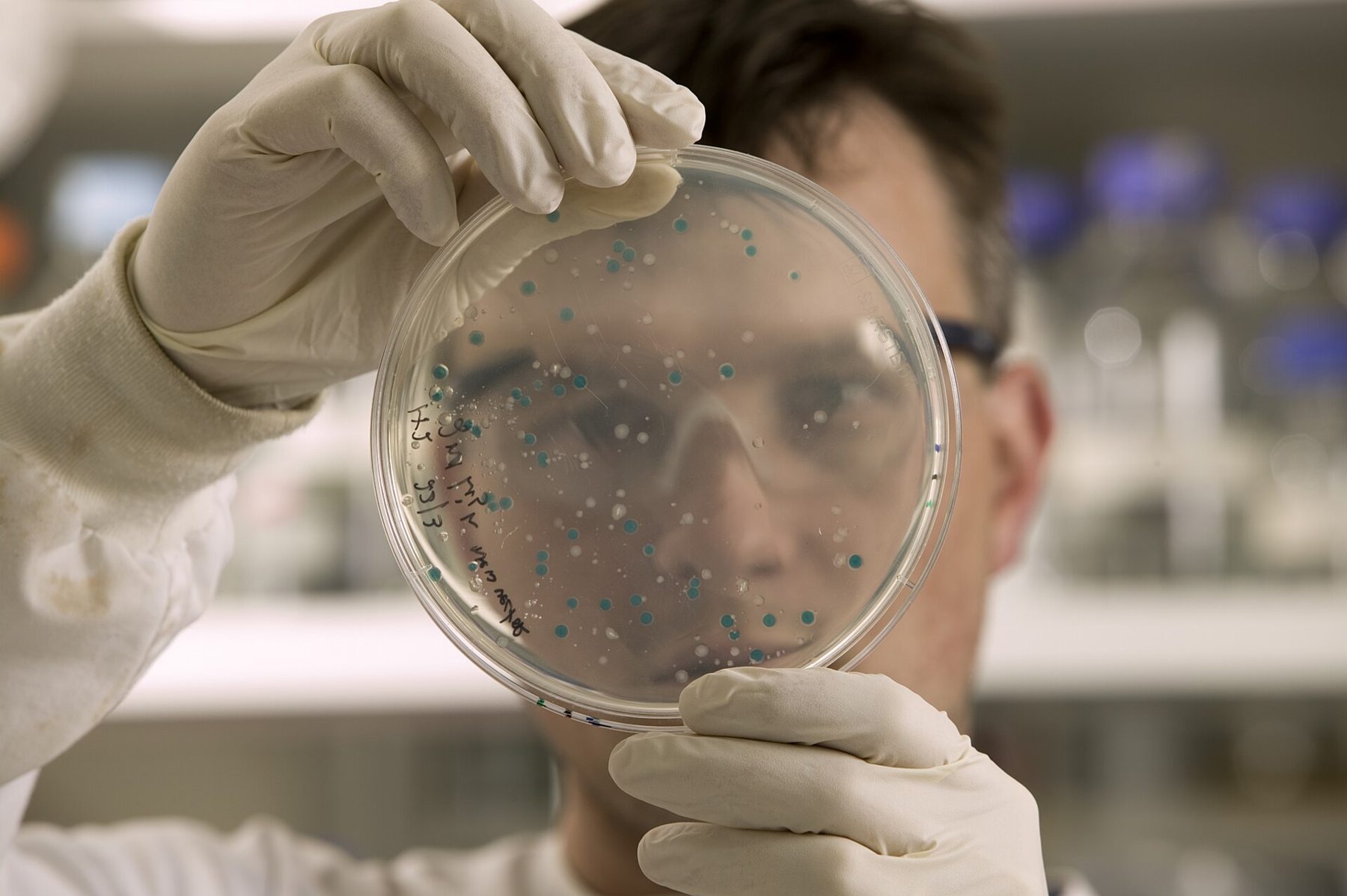 A scientist examining an agar dish of bacterial colonies